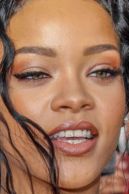 Rihanna before dental work
