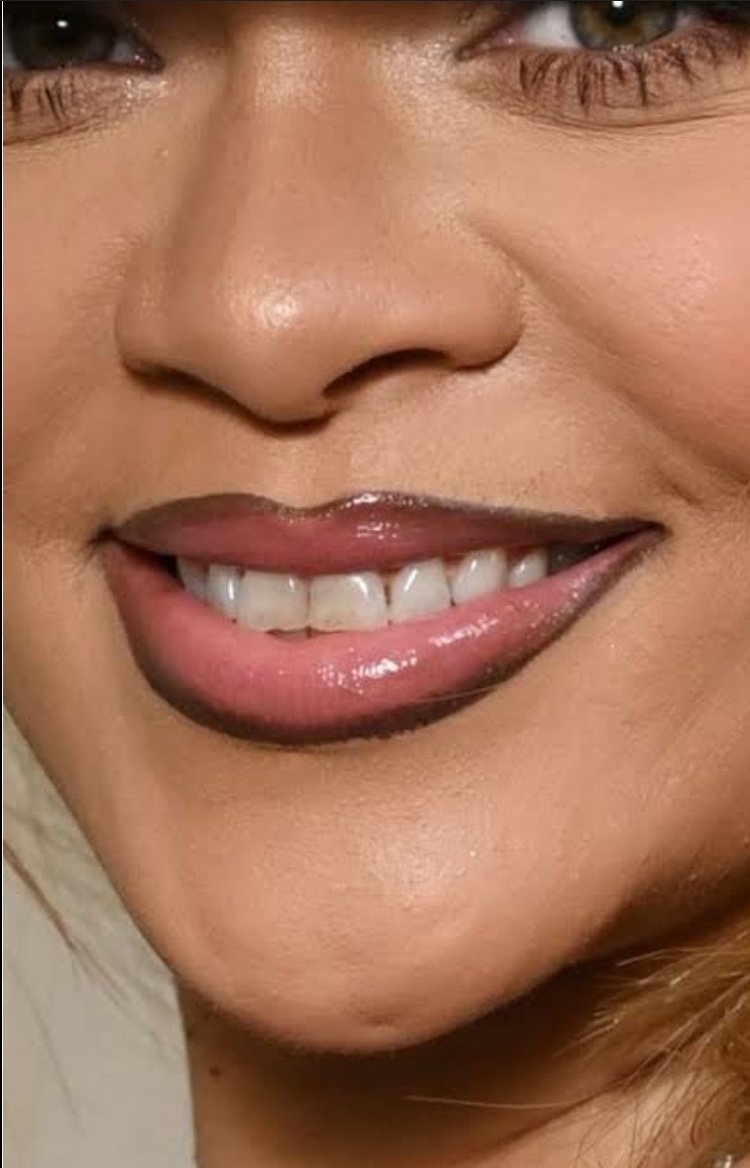Rihanna smile transformation